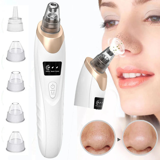 Upgraded Blackhead Remover Vacuum