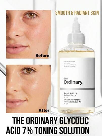 The Ordinary – Niacinamide 10% + Zinc 1% (30ml)